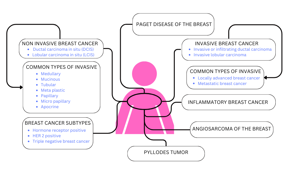 Types of Breast Cancer classification diagram